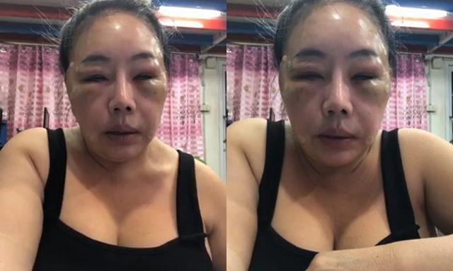 su that nga ngua ve nu dai gia tuyen chong "yeu" 28 lan/ngay: khong giau co, livestream kiem tien - 2