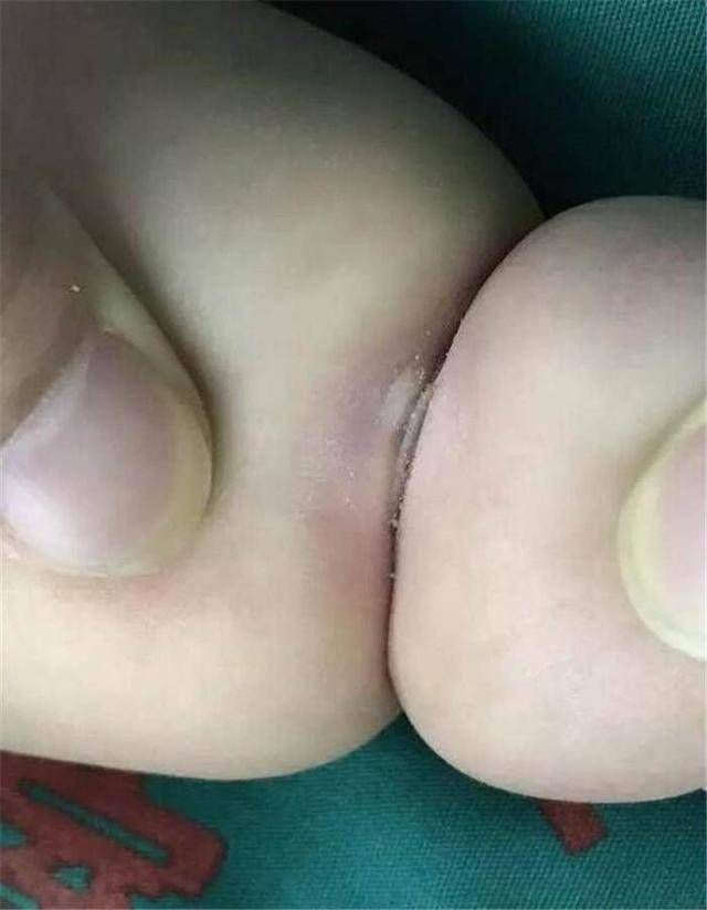 tay con chia ngan ai cung khen de thuong, me khoc ngat vi bac si bao "phai cat bo" - 3