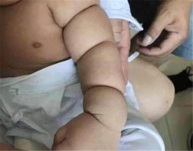 tay con chia ngan ai cung khen de thuong, me khoc ngat vi bac si bao "phai cat bo" - 1