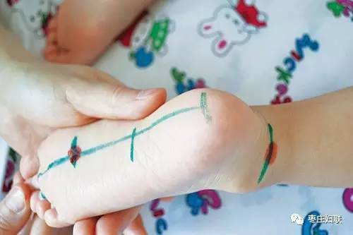 Hai bộ phận này của bé sơ sinh, càng được chạm nhiều trẻ càng thông minh - 3