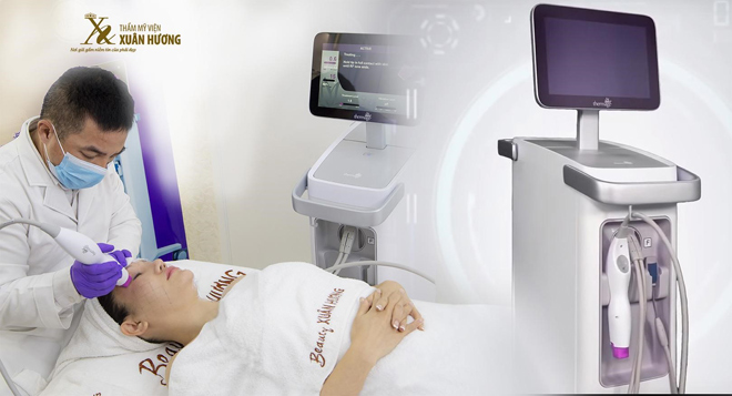 thermage 4.0 flx thach thuc moi lan da lao hoa da co mat tai ha noi - 4