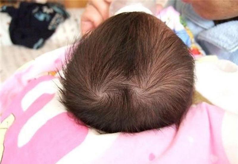 Mỗi đứa trẻ sinh ra đều mang một dấu hiệu đặc biệt ở: Dấu vân tay, những vết chàm và cuối cùng là xoáy tóc.
