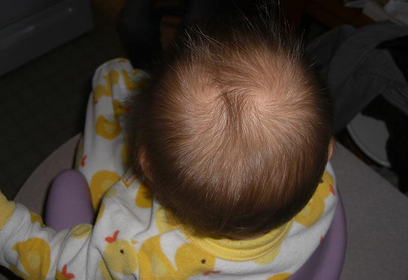 Một điều thú vị được chiêm nghiệm, đó là những em bé có hai xoáy tóc thường sau này có rất nhiều tài lẻ, thông minh bẩm sinh.
