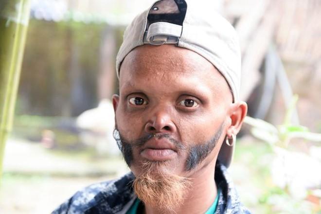 Sốc độc lạ: Tài xế xe bus lưỡi dài khó tin, liếm được tận trán khiến trẻ con amp;#34;khiếp sợamp;#34; - 3