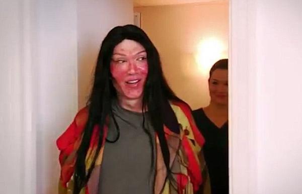 Khuôn mặt biến dạng, nam ca sĩ trẻ qua đời sau hơn 300 lần trùng tu nhan sắc - 5