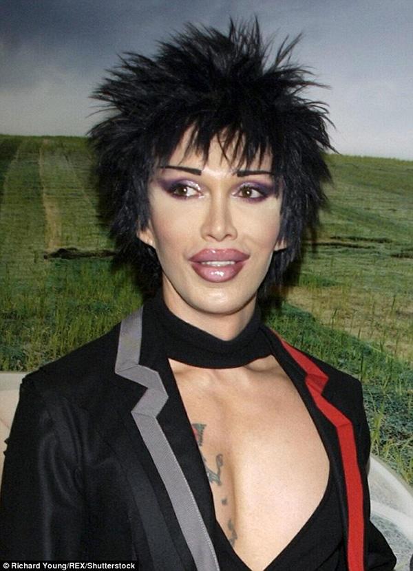 Khuôn mặt biến dạng, nam ca sĩ trẻ qua đời sau hơn 300 lần trùng tu nhan sắc - 4