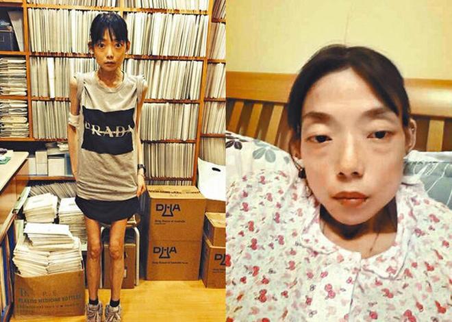 Sao nữ đình đám một thời bị chồng ruồng bỏ vì mắc bệnh nan giải khiến cơ thể tàn tạ - 2