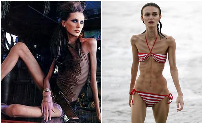 Sao nữ đình đám một thời bị chồng ruồng bỏ vì mắc bệnh nan giải khiến cơ thể tàn tạ - 4