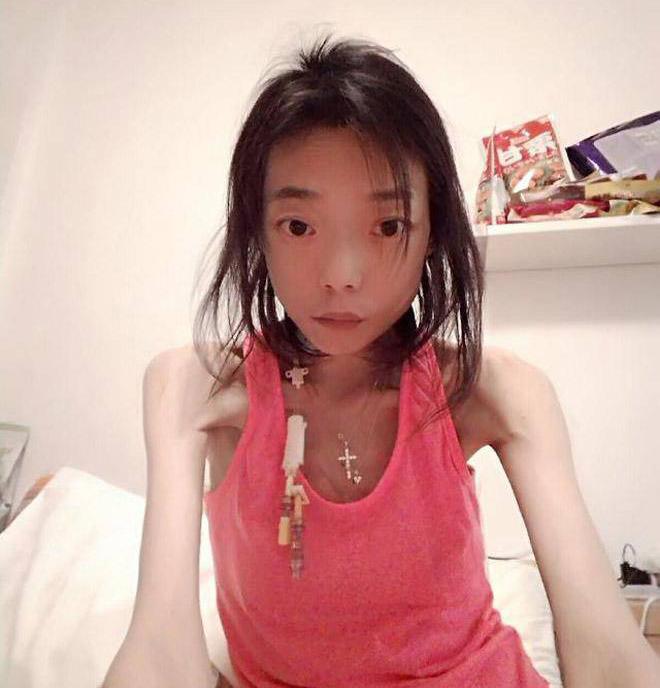 Sao nữ đình đám một thời bị chồng ruồng bỏ vì mắc bệnh nan giải khiến cơ thể tàn tạ - 3