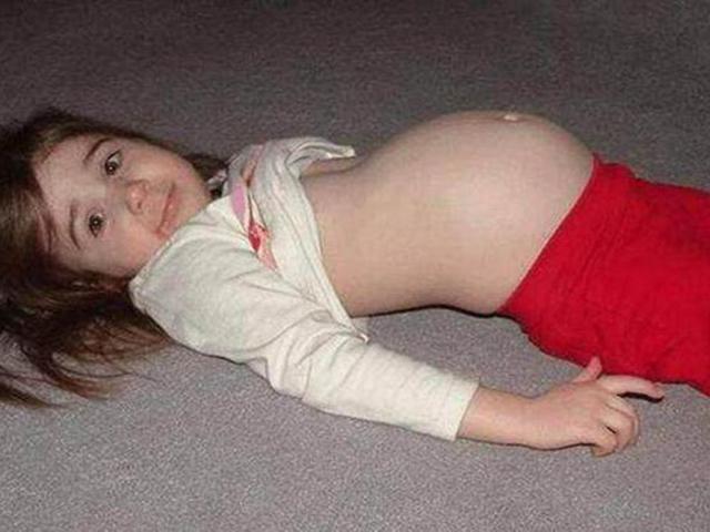 Bé gái 9 tuổi kêu đau bụng, bác sĩ nói: Có một đứa trẻ ở trong