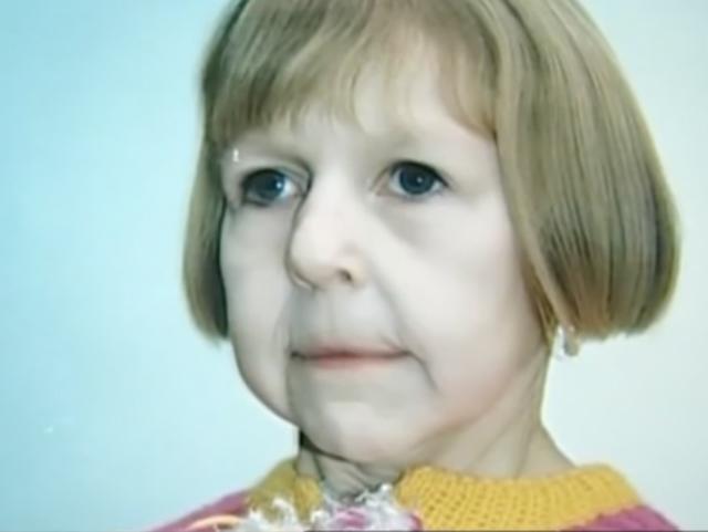 Bị bỏ rơi vì gương mặt bà lão lúc chào đời, 23 năm sau cô gái làm nên kỳ tích - 2