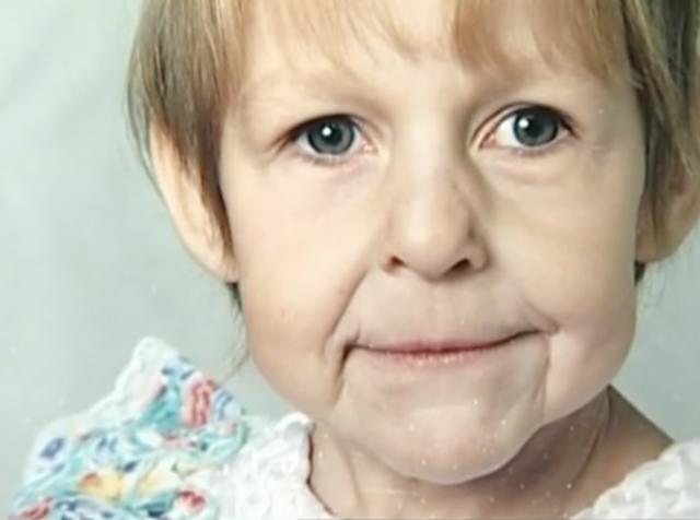 Bị bỏ rơi vì gương mặt bà lão lúc chào đời, 23 năm sau cô gái làm nên kỳ tích - 3