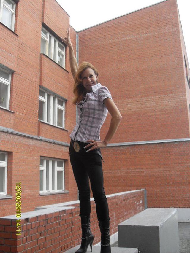 Bị bỏ rơi vì gương mặt bà lão lúc chào đời, 23 năm sau cô gái làm nên kỳ tích - 5