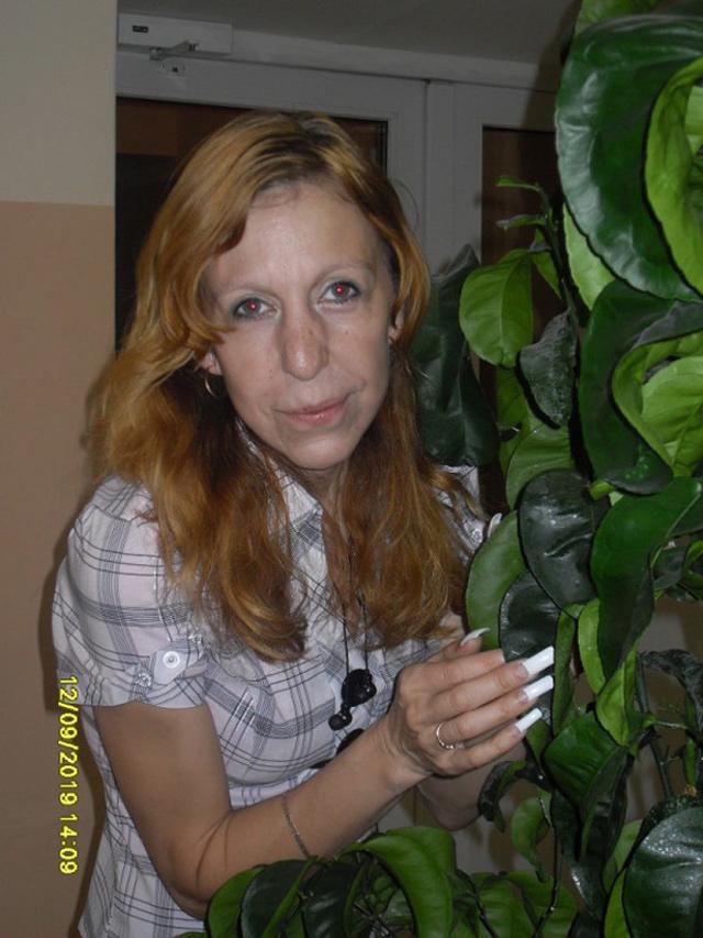 Bị bỏ rơi vì gương mặt bà lão lúc chào đời, 23 năm sau cô gái làm nên kỳ tích - 6