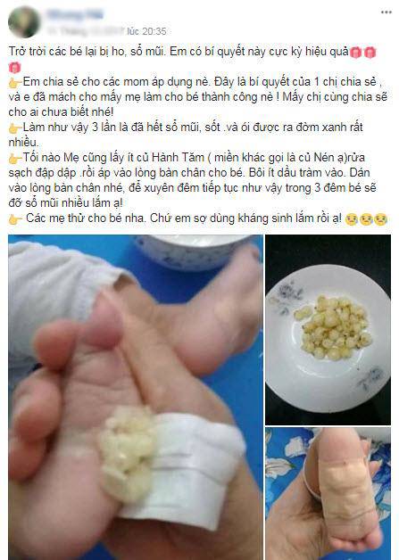 Mẹ vội vã trị ho cho con theo cách dân gian, trẻ nhỏ bị phỏng rộp, tróc da đau đớn - 3