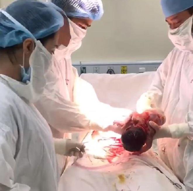 me ha noi hiem muon 5 nam 2 lan ivf that bai, co con nho chiec giuong ky la - 3
