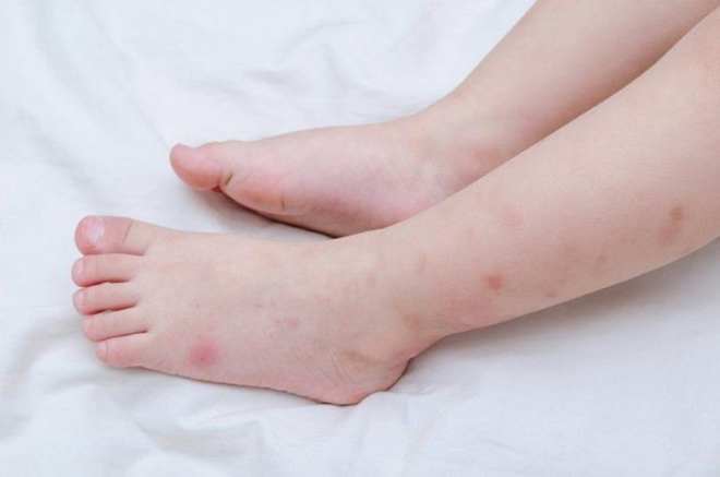 amp;#34;Khỏe hô hấp, bắt muỗi nhanhamp;#34;, hưởng ứng chiến dịch vì sức khỏe cộng đồng - 1