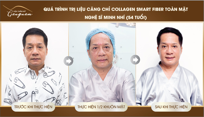 lam 1 gio tre ngay 10 tuoi- ns minh nhi lan dau tho lo bi quyet tre hoa tuc thi - 5