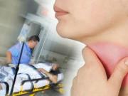 Sức khỏe - Người phụ nữ bị ung thư thực quản, BS nói 2 kiểu ăn uống này của cô rất có hại