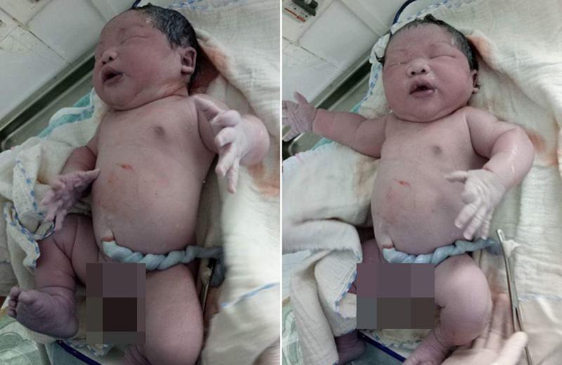 Trên thực tế, danh sách này của Woderlist vẫn chưa cập nhật đầy đủ các trường hợp trên thế giới. Ngay tại Việt Nam vào tháng 10/2017, một bé trai chào đời tại Vĩnh Phúc cũng có cân nặng lên tới 7,1kg. 
