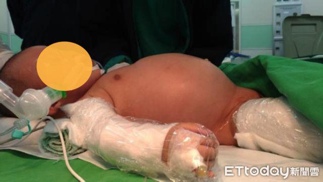 Cứ nghĩ con 3 tháng tuổi bị đầy bụng, nhìn phim chụp X-quang bố mẹ ngỡ ngàng - 1