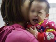 Sức khỏe - Con méo mồm vì mẹ tắm khuya, bác sĩ cảnh báo sai lầm khiến con nhập viện khi trời lạnh