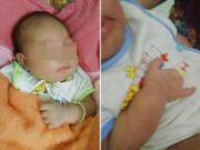 Bà bầu - Siêu âm bình thường, mẹ sinh con dị tật không ngón tay, phẫn nộ nhất là thái độ người chồng