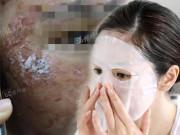 Làm đẹp - Hãi hùng với làn da lở loét vì sử dụng mặt nạ giấy, tất cả cũng chỉ tại ham rẻ