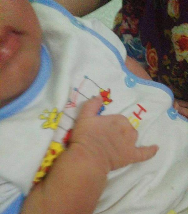 Siêu âm bình thường, mẹ sinh con dị tật không ngón tay, phẫn nộ nhất là thái độ người chồng - 2