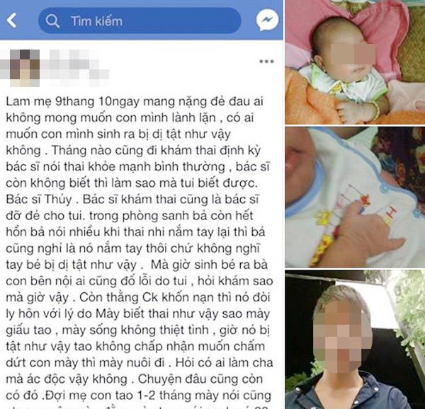 Siêu âm bình thường, mẹ sinh con dị tật không ngón tay, phẫn nộ nhất là thái độ người chồng - 1