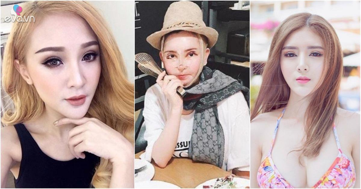 Rùng mình trước chuyện phẫu thuật thẩm mỹ của 3 “búp bê di động“ nghiện dao kéo