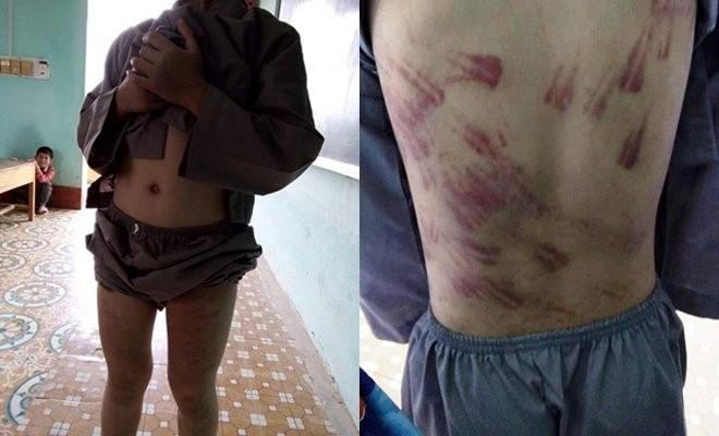 Gia cảnh khốn khó của bé trai 10 tuổi bị sư trụ trì đánh bầm tím khắp cơ thể - 1