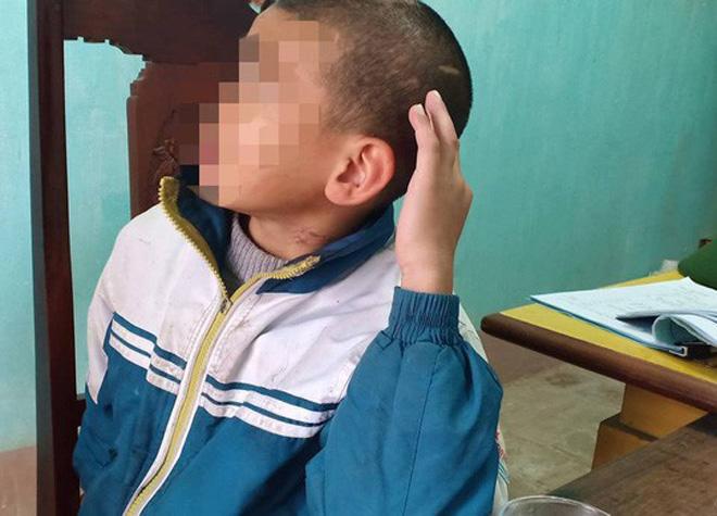 Gia cảnh khốn khó của bé trai 10 tuổi bị sư trụ trì đánh bầm tím khắp cơ thể - 2
