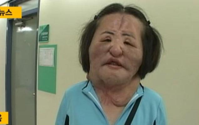 han mi ok: tu co gai dep co tieng tro thanh "tham hoa tham my", gio chet trong co doc - 2