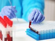 Bà bầu - Các xét nghiệm máu khi mang thai nhất định mẹ bầu phải biết