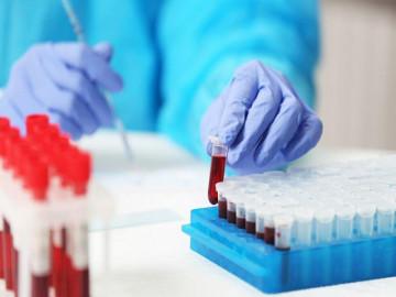 Các xét nghiệm máu khi mang thai nhất định mẹ bầu phải biết