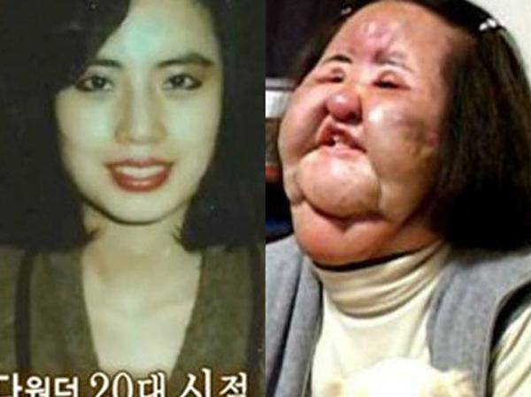 ngoi sao 24/7: danh ca thanh xuan "dao keo", co gai dep co tieng kbiz co doc den cuoi doi - 1