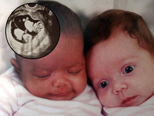 4 ông bố được dân mạng gọi tên vua đổ vỏ vì vợ đẻ hai con song sinh khác cha