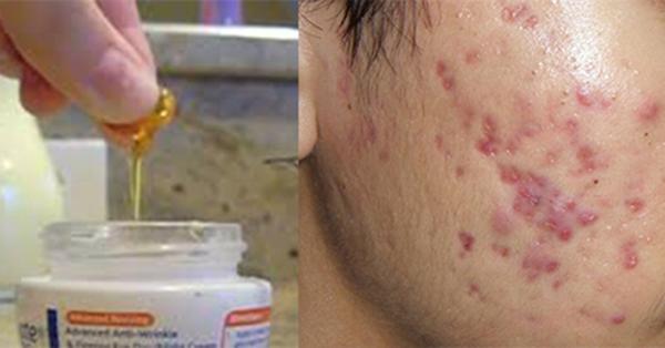 chi can dung vitamin e theo cach nay, ban se tiet kiem duoc ca nui tien tu mua my pham - 2