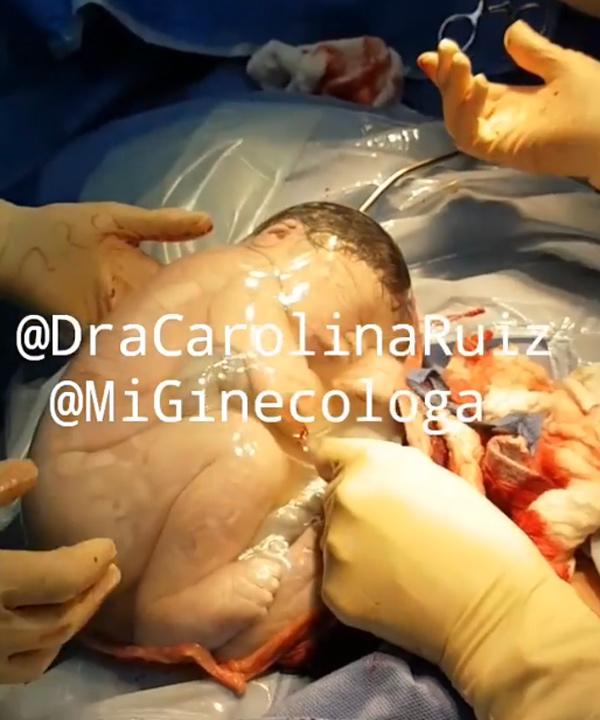 em be nam trong tui oi "ngu quen doi", bac si mo xong phai goi mai moi day - 1