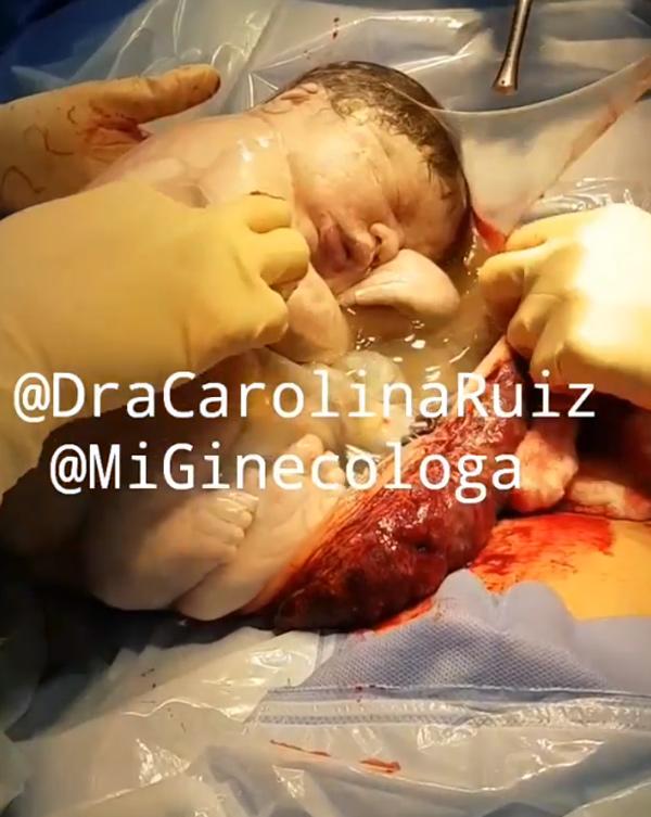 em be nam trong tui oi "ngu quen doi", bac si mo xong phai goi mai moi day - 3