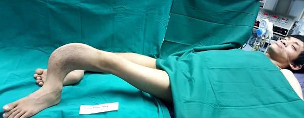 28 năm nuốt nước mắt bị trêu amp;#34;đi giống ếchamp;#34;, chàng trai gặp phép màu sau tai nạn bất ngờ - 1