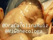 Bà bầu - Em bé nằm trong túi ối "ngủ quên đời", bác sĩ mổ xong phải gọi mãi mới dậy