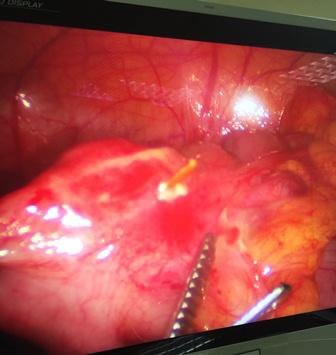 khong the tin duoc co gai phai di vien phau thuat vi vat hau het nguoi viet deu dung - 1