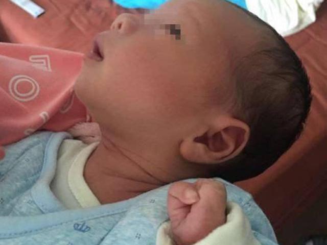 Không muốn sinh con ra bị dị tật, mẹ bầu tuyệt đối đừng làm những việc này!