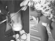 Sức khỏe - Chủ quan khi thấy "vùng kín" con lớn bất thường, 2 năm sau cha mẹ vội đưa con nhập viện