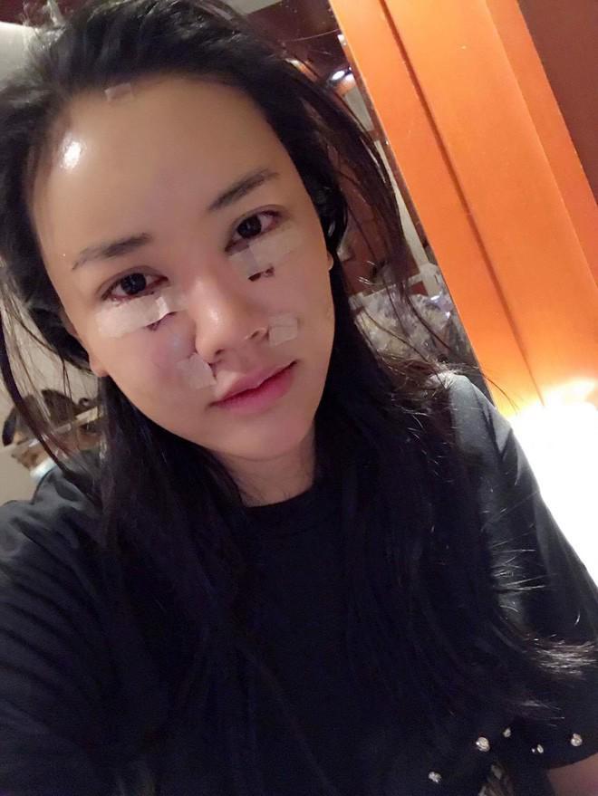 Bình thường đã đẹp rồi, vì sao Elly Trần và 3 bà mẹ đơn thân này vẫn đi... sửa mặt? - 9