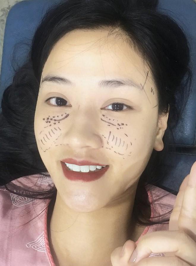 Bình thường đã đẹp rồi, vì sao Elly Trần và 3 bà mẹ đơn thân này vẫn đi... sửa mặt? - 10