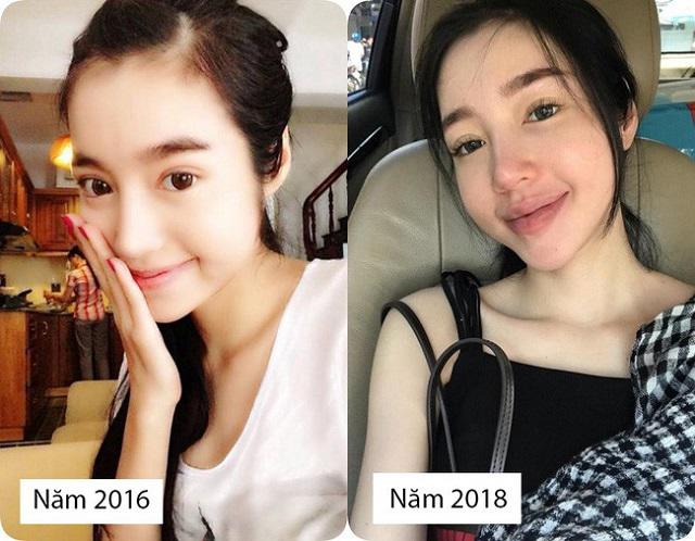 Bình thường đã đẹp rồi, vì sao Elly Trần và 3 bà mẹ đơn thân này vẫn đi... sửa mặt? - 5