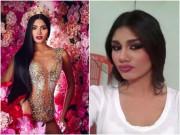 Làm đẹp - Có bất công cho H’Hen Niê khi Á hậu Hoàn vũ 2018 lộ ảnh “dao kéo” trước khi đăng quang?